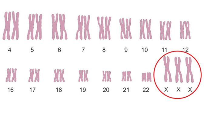 figure5)super-female-sundrome